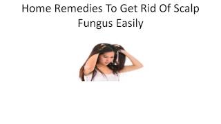 Home Remedies To Get Rid Of Scalp Fungus | How to Get Rid of Ringworm Fast at Home