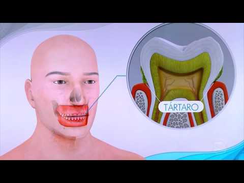 Bem Estar   No Brasil, 20% das pessoas não vão ao dentista por falta de dinheiro