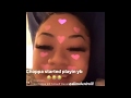 Blasian On Live While Nle Choppa Listens To Youngboy