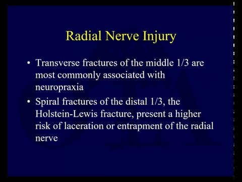 Humeral Shaft Fractures 3 - Complications (OTA lecture series III u04c)