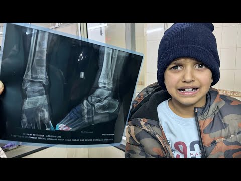 Pair Me Khatarnak Chot Lag Gayi 🥺 | Cycle Ride gone wrong | Yaatri