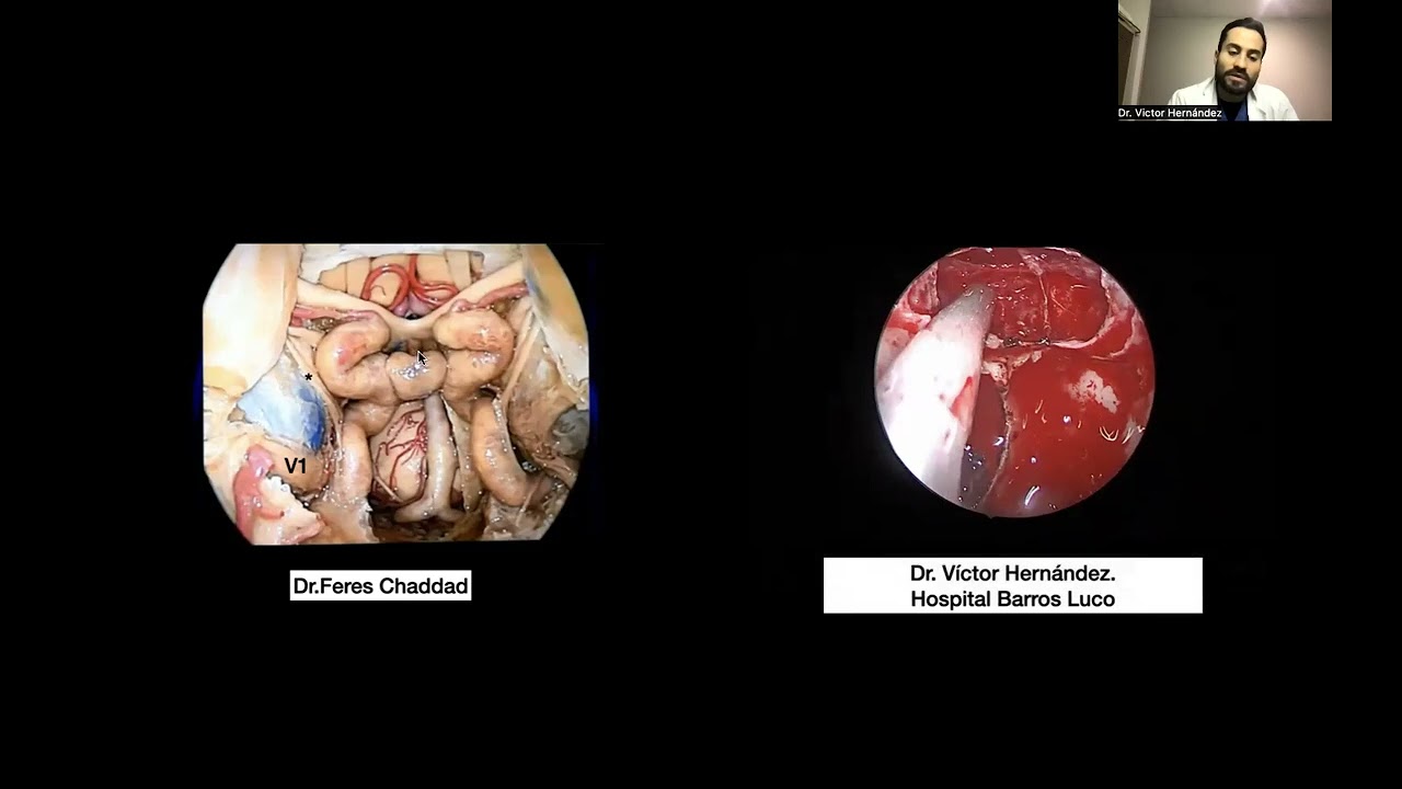 Victor Hernandez Alvarez-9