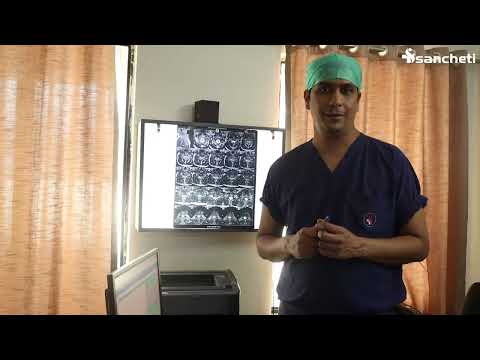 Patient Testimonials | Dr. Ajay Kothari - Spine Surgeon | Shivaji Nagar, Pune