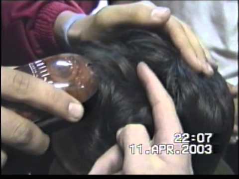 vice campeões andebol 2003