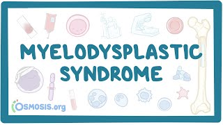Download Lagu Myelodysplastic syndromes - causes, symptoms, diagnosis, treatment, pathology Thumbnail
