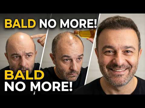 I Stopped Going Bald With This One Weird Remedy