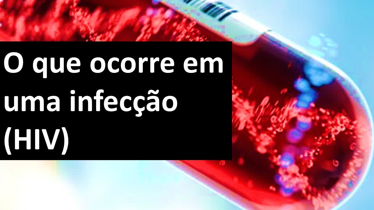 O que ocorre em uma infecção (HIV) | Odontologia | Dra Bianca Rosa