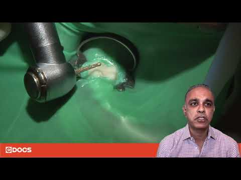 Tip of the Day: Access Burs for Endo