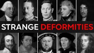 *No ads* 25 BRITISH Kings and Queens With SECRET Disabilities And Deformities | For Sleep
