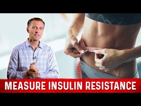 Adrenal Fatigue Is Cortisol Responsible for Your Diabetes Dr Berg