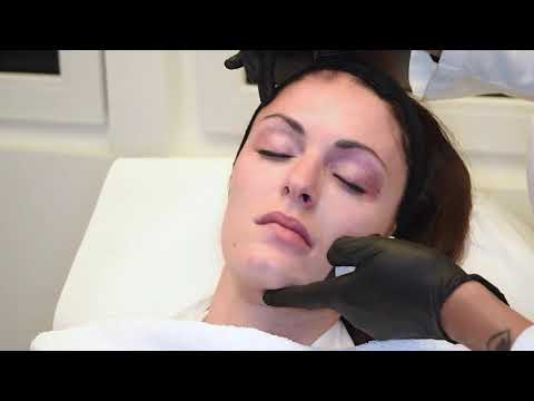 Dr. Natalie Keller & aesthetic visions – Lippenformung