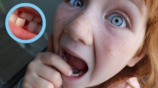 WiGGLE TOOTH!!  Adley&#39;s First Loose Tooth! Family Bike Ride a House Tour &amp; Crafts with Niko n Adley