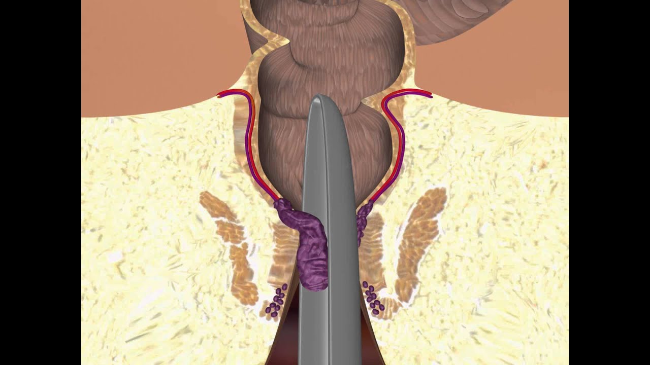 Alberto Carrillo Acosta-5