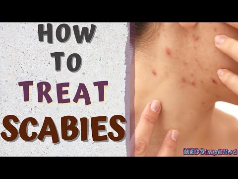 , title : 'HOW TO TREAT SCABIES/scabies treatment at home'