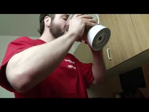 Devon Nicholson Incivek Treatment Week 17