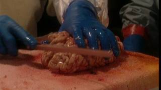 Autopsy - Voices of Death (2)