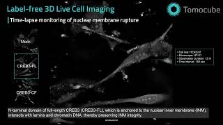 Karyoptosis cell death_Label free live cell imaging by Holotomography