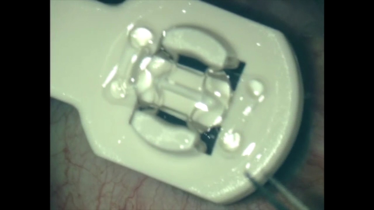 Alejandro Silva Moreno-11