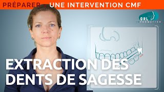 Extraction des dents de sagesse | Information patient ORL