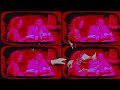 76 Trombones (From The "Music Man") | The Arthur Lyman Group