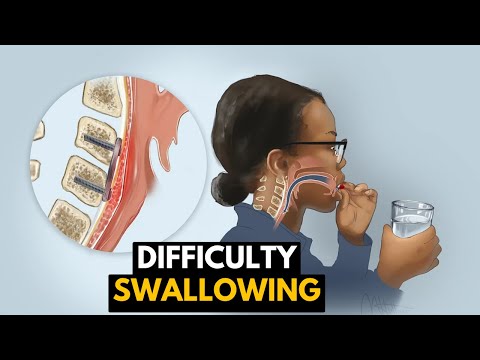 Struggling to Swallow? Understanding the Causes and Solutions
