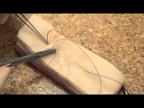 Subcuticular Suturing