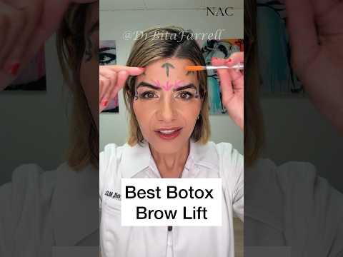 #botoxbrowlift #browlift #botoxtraining #drbitafarrell #botox #brows
