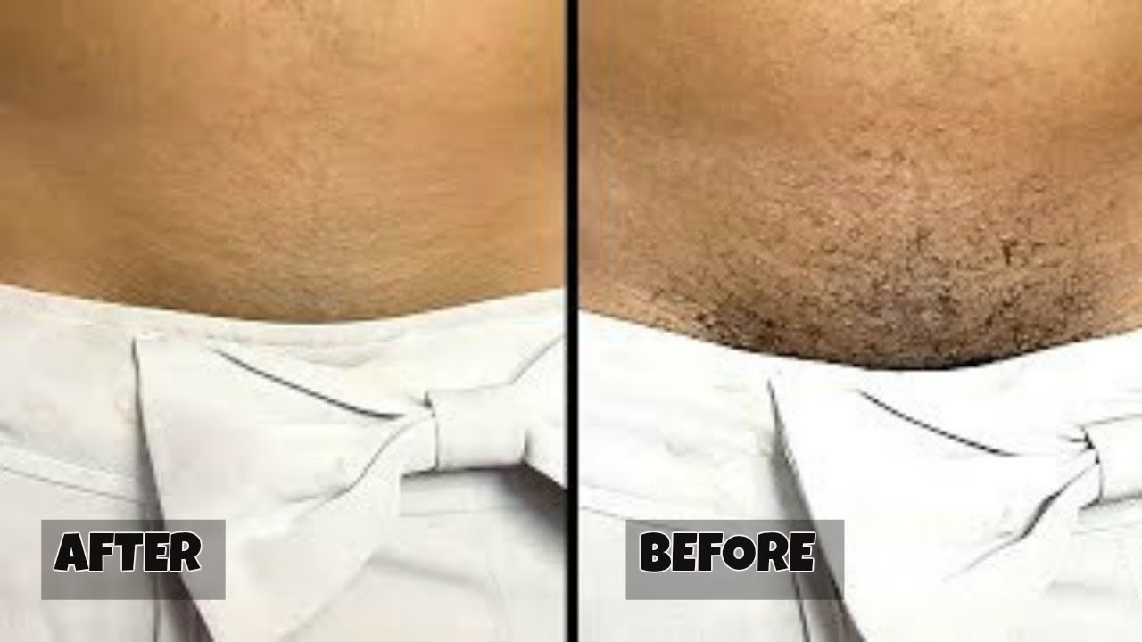 Stop Shaving This Is How You Should Remove Pubic Hair Without