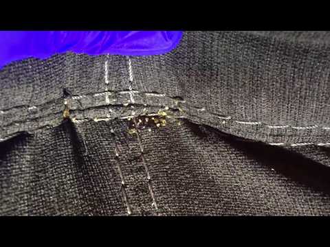 1st YouTube video about are bed bugs termites