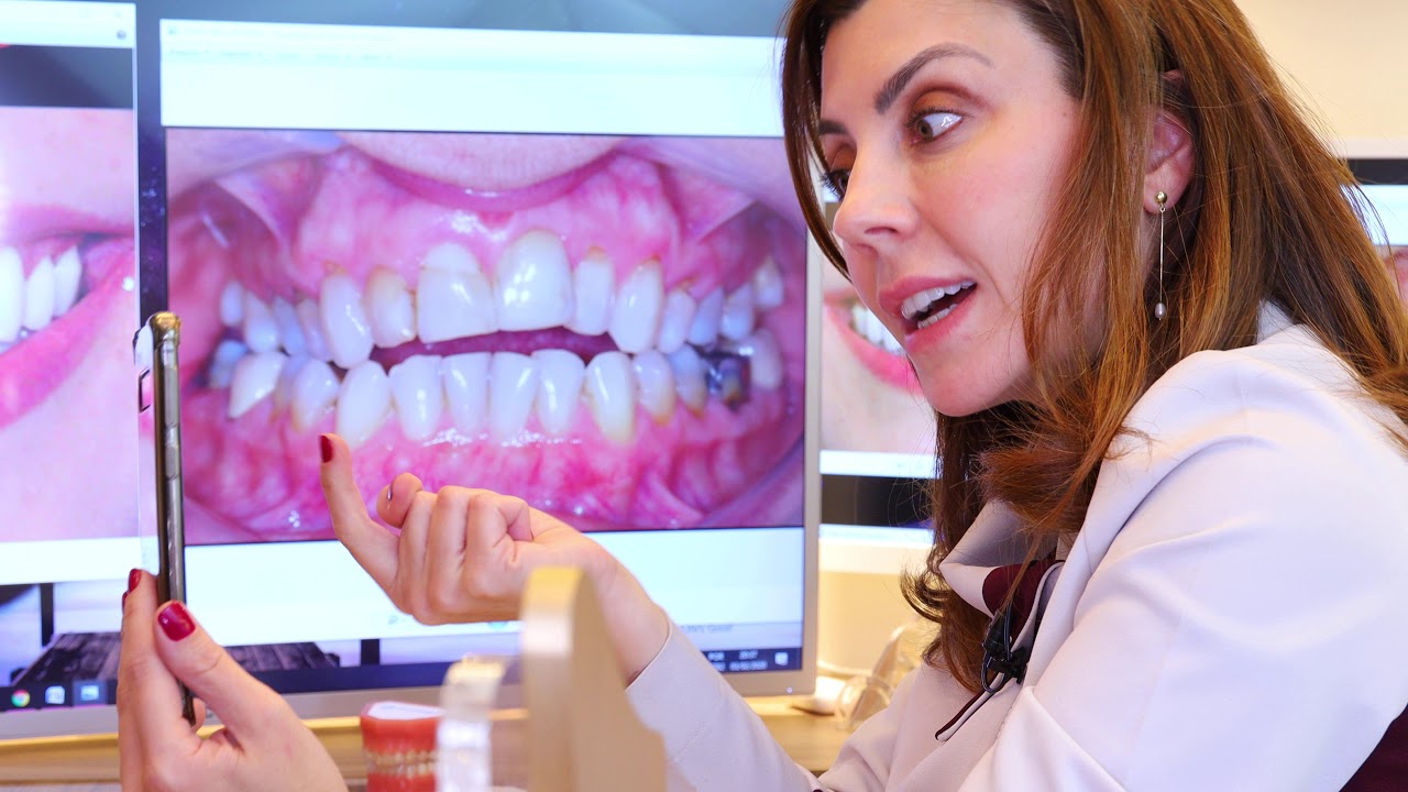 COMO APRESENTAR PLANOS DE TRATAMENTOS - PARTE 1