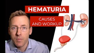 Hematuria: causes and evaluation of blood in your urine