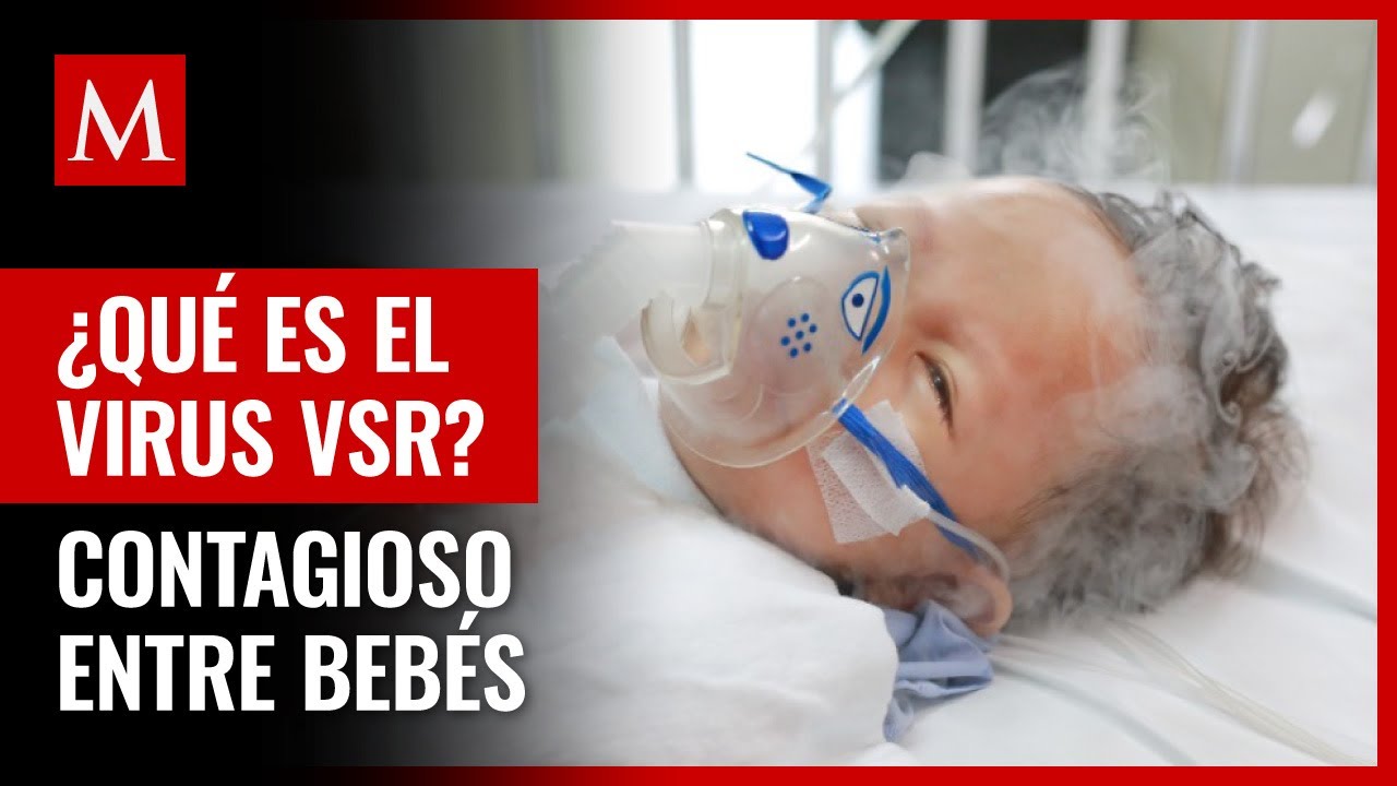 Virus Sincitial Respiratorio O Vsr Qué Es Y Síntomas En México