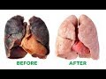 Hidup Tanpa Rokok Ini Yang Terjadi Pada Tubuh Saat Berhenti Merokok