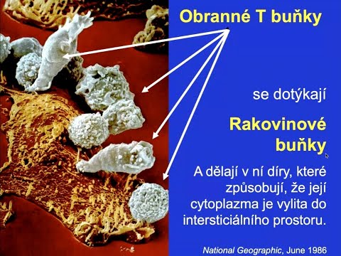 Imunita a naše zdravie - MUDr. Milan Moskala