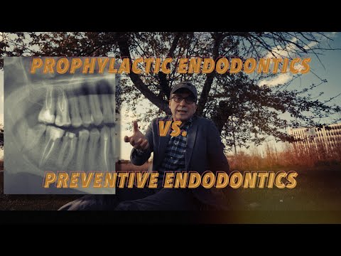 Endodoncja profilaktyczn vs. endodoncja prewencyjna - jaka jest różnica?