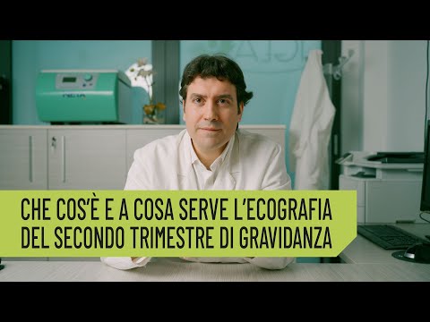 Nicola Volpe-6