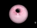 Learn About Endoscopy
