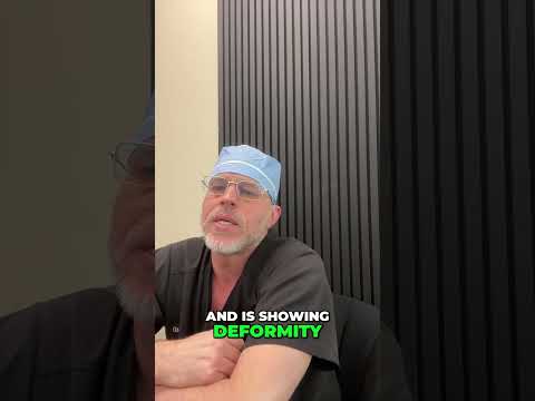 How Do You Maximize Fat Transfer Results and Avoid Deformity?
