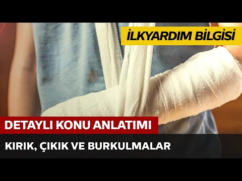 Kırık, Çıkık ve Burkulmalar Kırık, Çıkık ve Burkulmalar