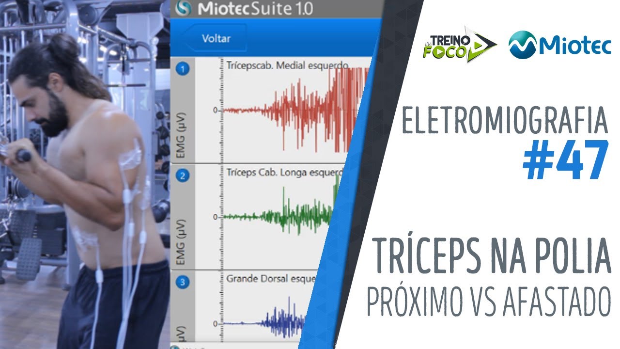 Tríceps na polia - Próximo vs Afastado - 💥 Veja a DIFERENÇA de Ativação!💥  - Eletromiografia #47