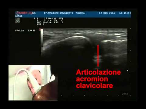 Come mal di osteocondrosi collo Se le spalle e mal di schiena