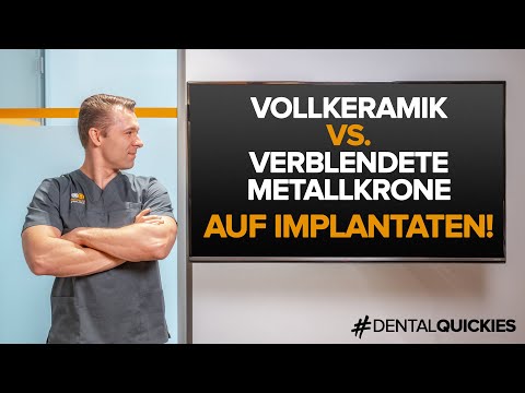 Was ist besser: Vollkeramikkrone oder Metallverblendkrone auf Implantaten? Wir klären auf!