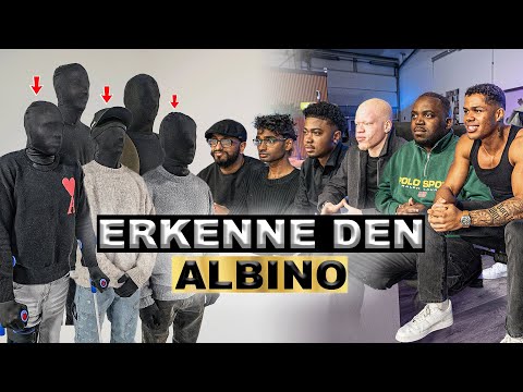 WEIß GEBOREN!.. 😱 Erkenne den ALBINO