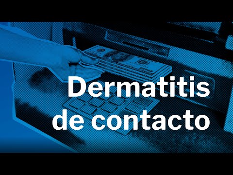 Invierno, frío y MANOS ROJAS. Dermatitis de contacto.