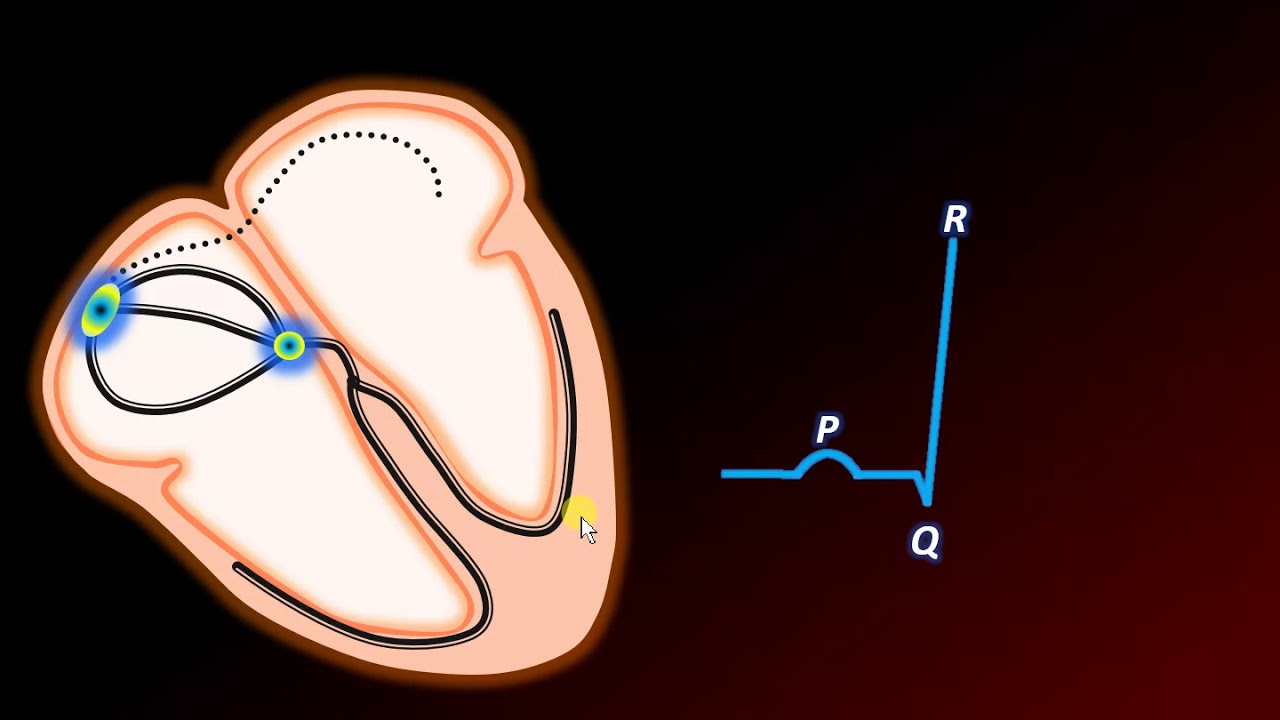 Formación de Ondas en el electrocardiograma