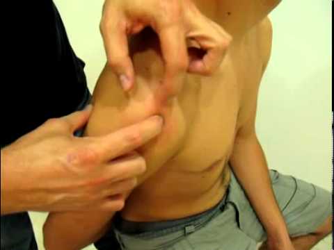 TENDÓN DEL SUPRAESPINOSO