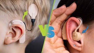 Cochlear Implants vs Hearing Aids: Which Is Right for You?