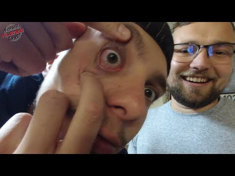 VLOG #73 - ANDRAŽ JE IZGUBIL ZOBE