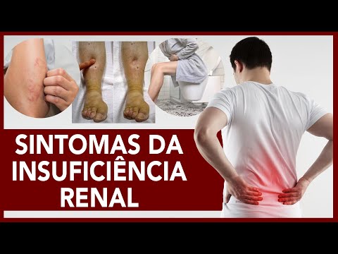 Sintomas da insuficiência renal