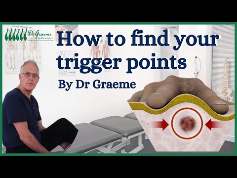 How to find trigger points